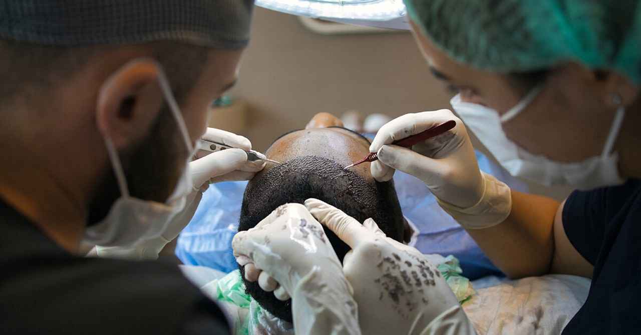 Top Non-Surgical Hair Restoration Treatments