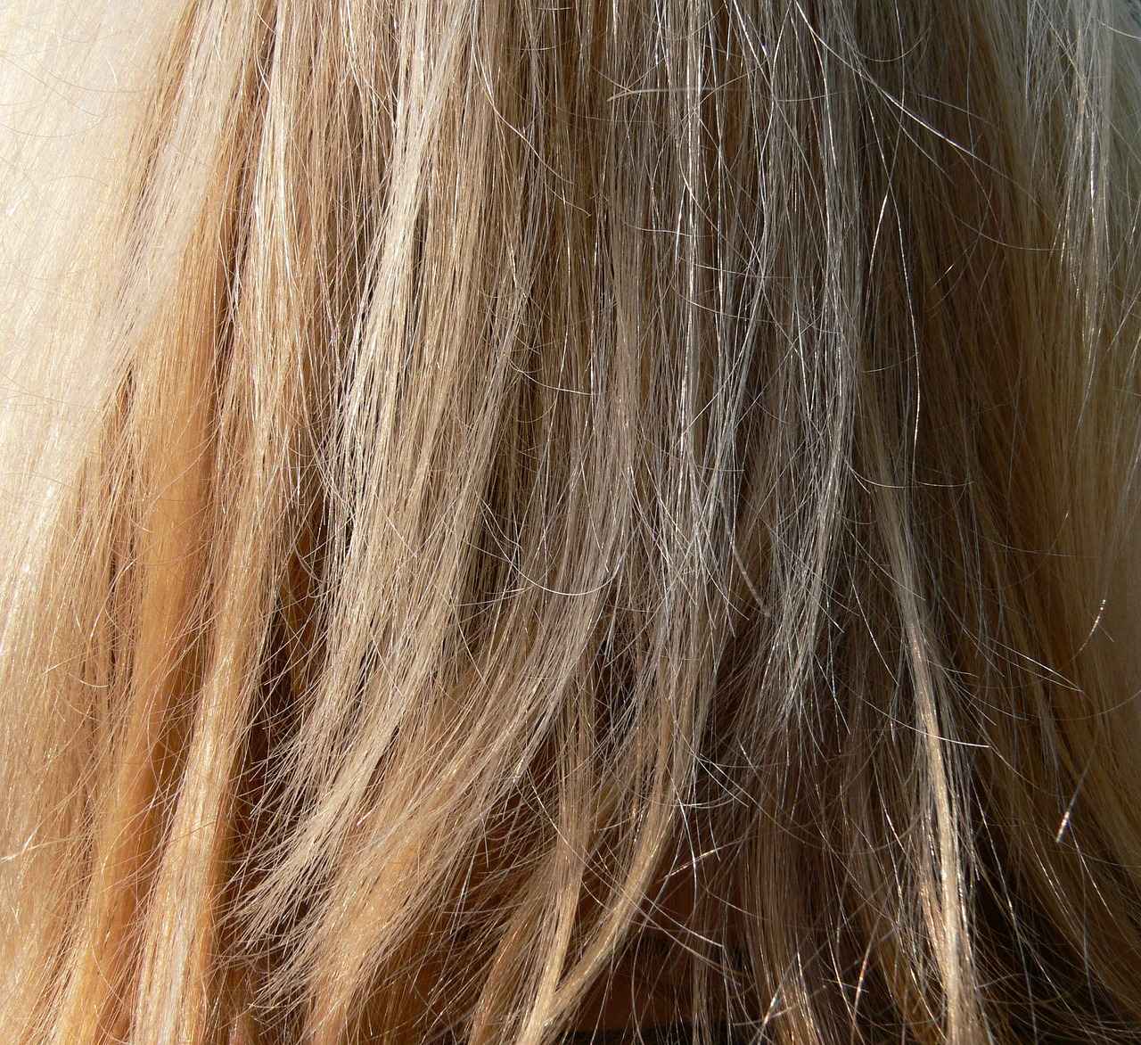 Cost Breakdown of Hair Transplants in the USA