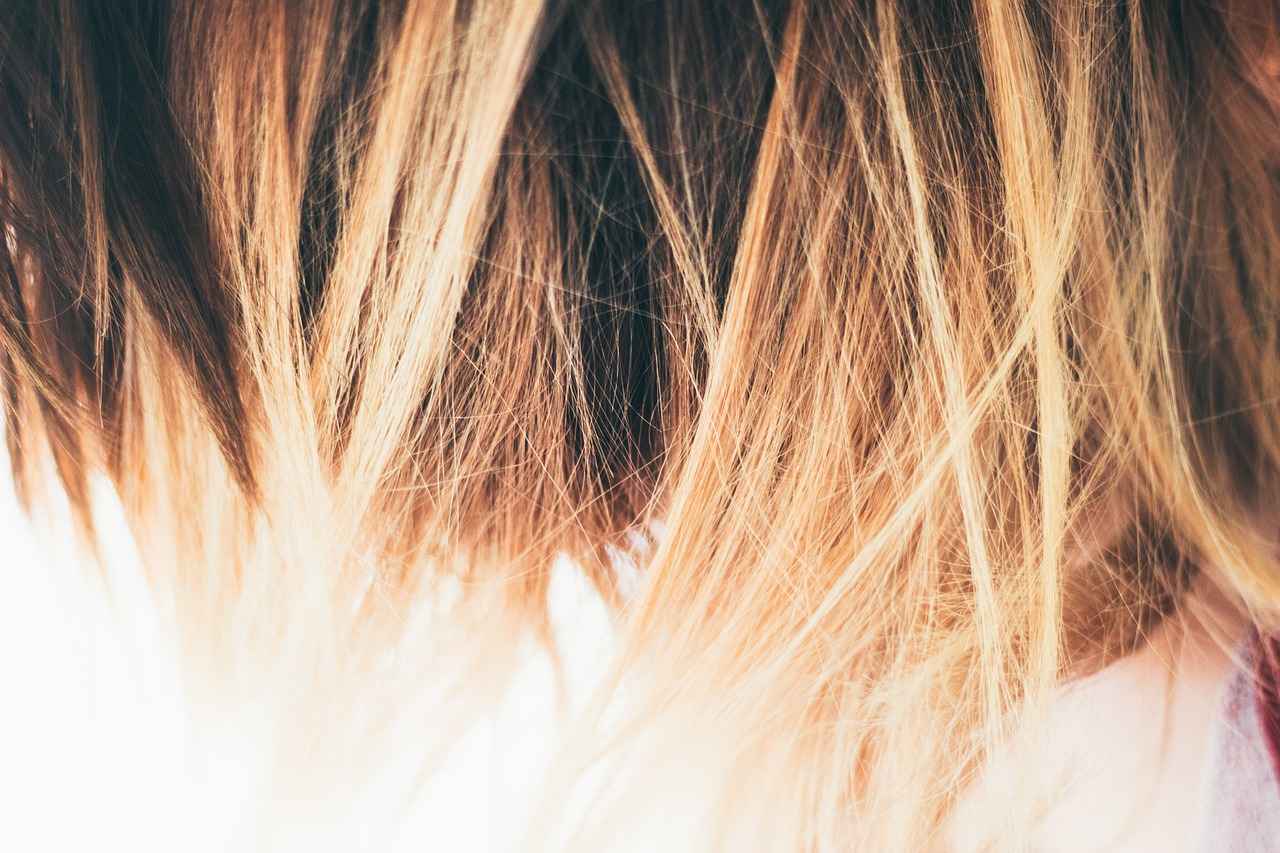 Top Clinics for Hair Transplants in Los Angeles