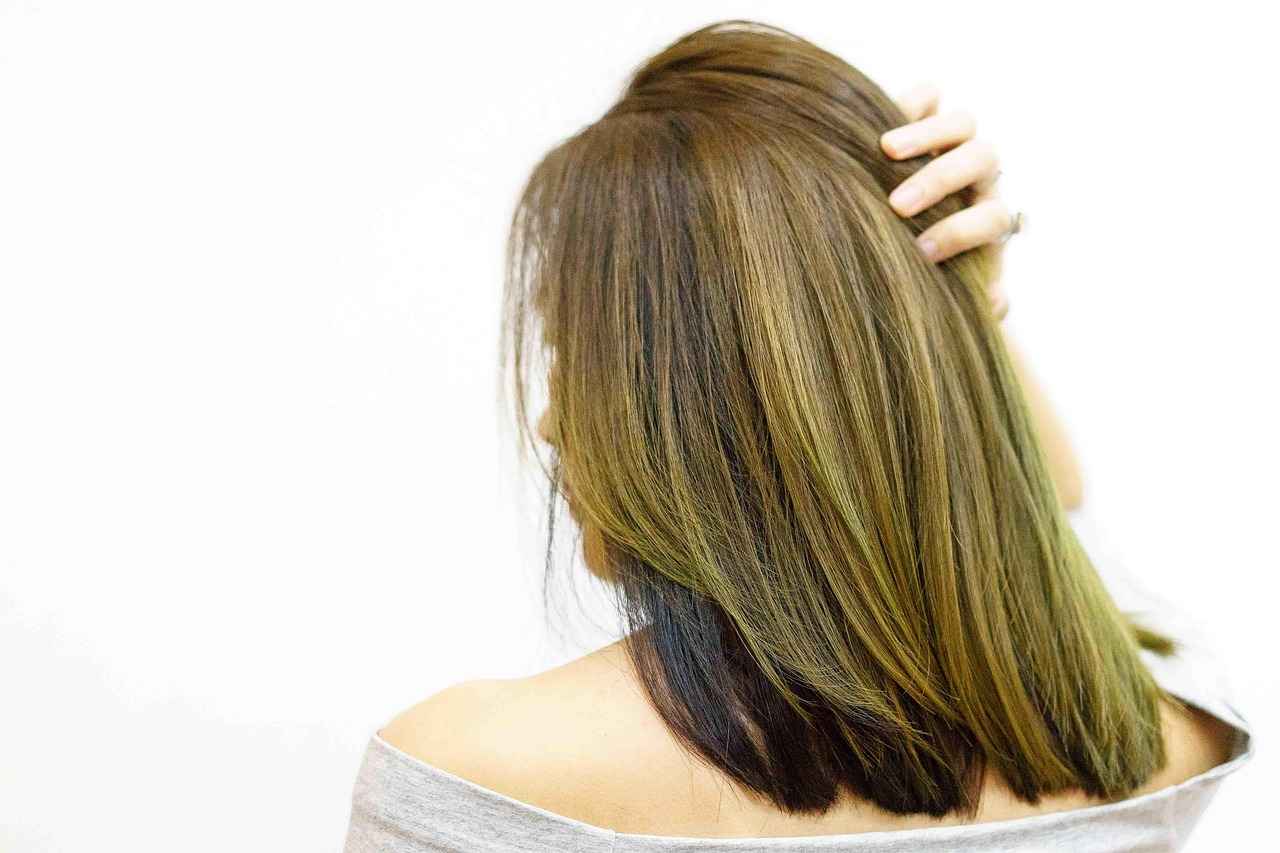 Top Clinics for Hair Transplants in Istanbul