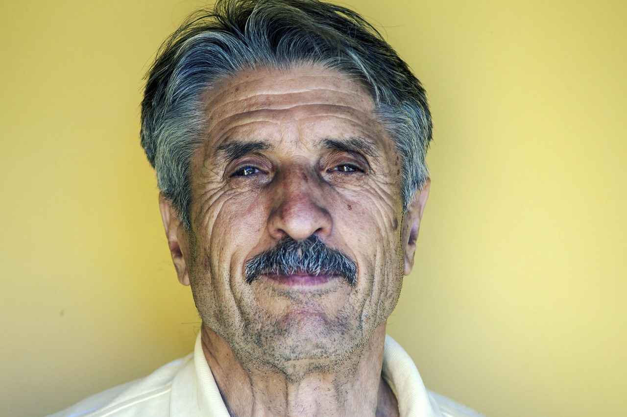 Understanding Hair Transplants