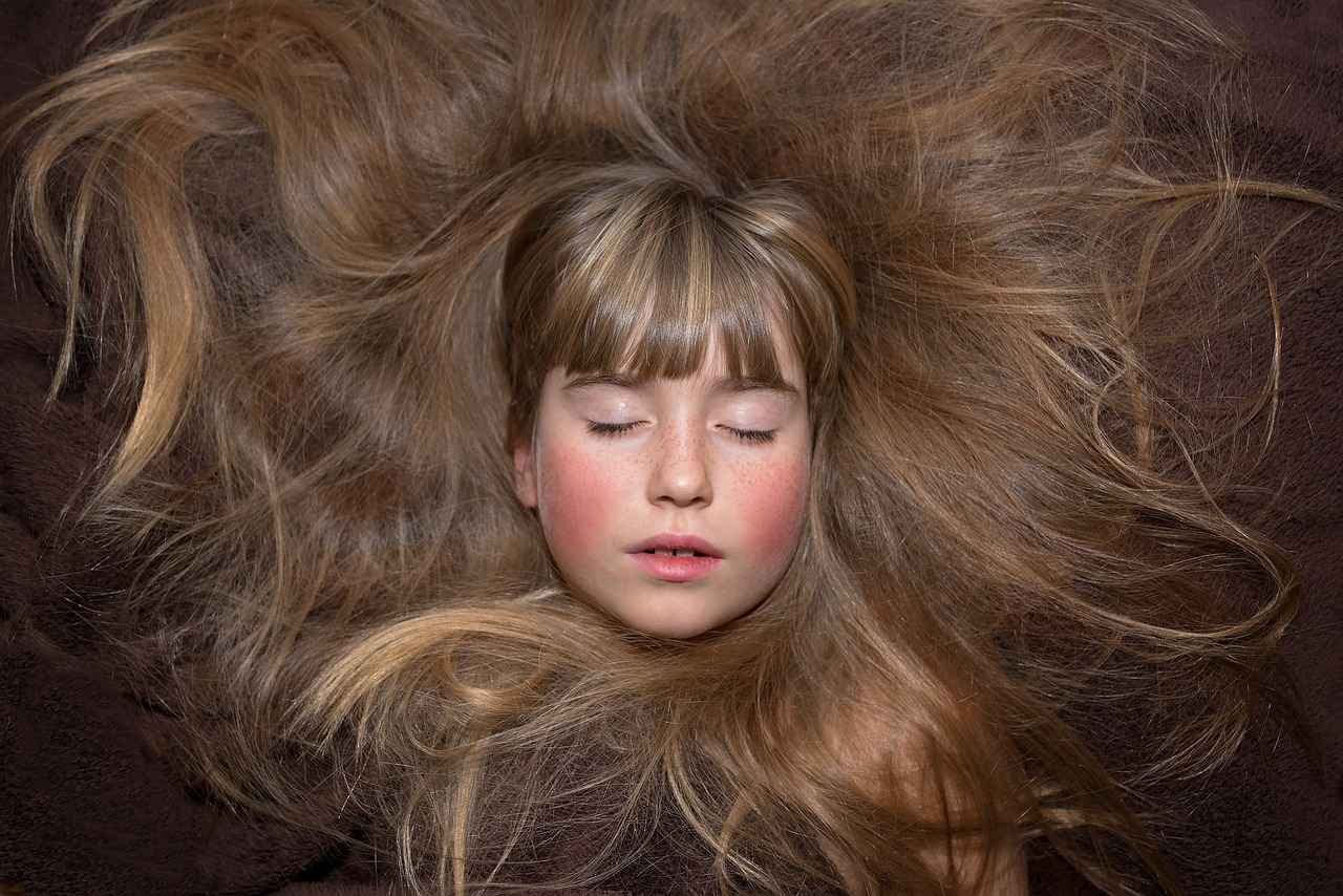 Understanding Hair Transplants
