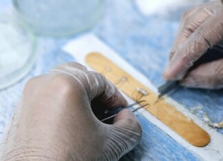 Non-Surgical Hair Thickening After A Transplant: Secrets Revealed