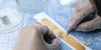 Your First Hours After Hair Transplant Surgery: Essential Tips Revealed