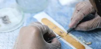 How To Prepare For Your Hair Transplant Procedure: Expert Tips