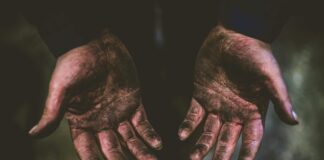 How To Assess Graft Survival In The First Month: Expert Tips Revealed