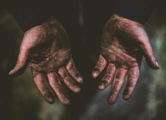 How To Assess Graft Survival In The First Month: Expert Tips Revealed