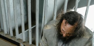 Everything You Need to Know About FUE Hair Transplant Revealed