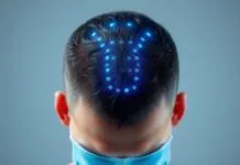 The AI Hair Transplant Revolution: Why I’m Skeptical (But Also Hopeful) The AI Hair Transplant Revolution: Why I'm Doubtful (But Also Hopeful)