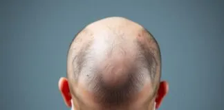 The Bald Truth: How Tech Is Revolutionizing Hair Transplants The Bald Truth: How Technology Is Revolutionizing Hair Transplants