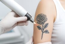 Say Goodbye to Unwanted Ink: Top Clinics for Painless Laser Tattoo Erasure Say Goodbye to Unwanted Ink: Top Clinics for Painless Laser Tattoo Erasure