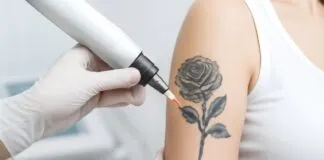 Say Goodbye to Unwanted Ink: Top Clinics for Painless Laser Tattoo Erasure Say Goodbye to Unwanted Ink: Top Clinics for Painless Laser Tattoo Erasure