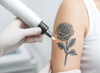 Say Goodbye to Unwanted Ink: Top Clinics for Painless Laser Tattoo Erasure Say Goodbye to Unwanted Ink: Top Clinics for Painless Laser Tattoo Erasure